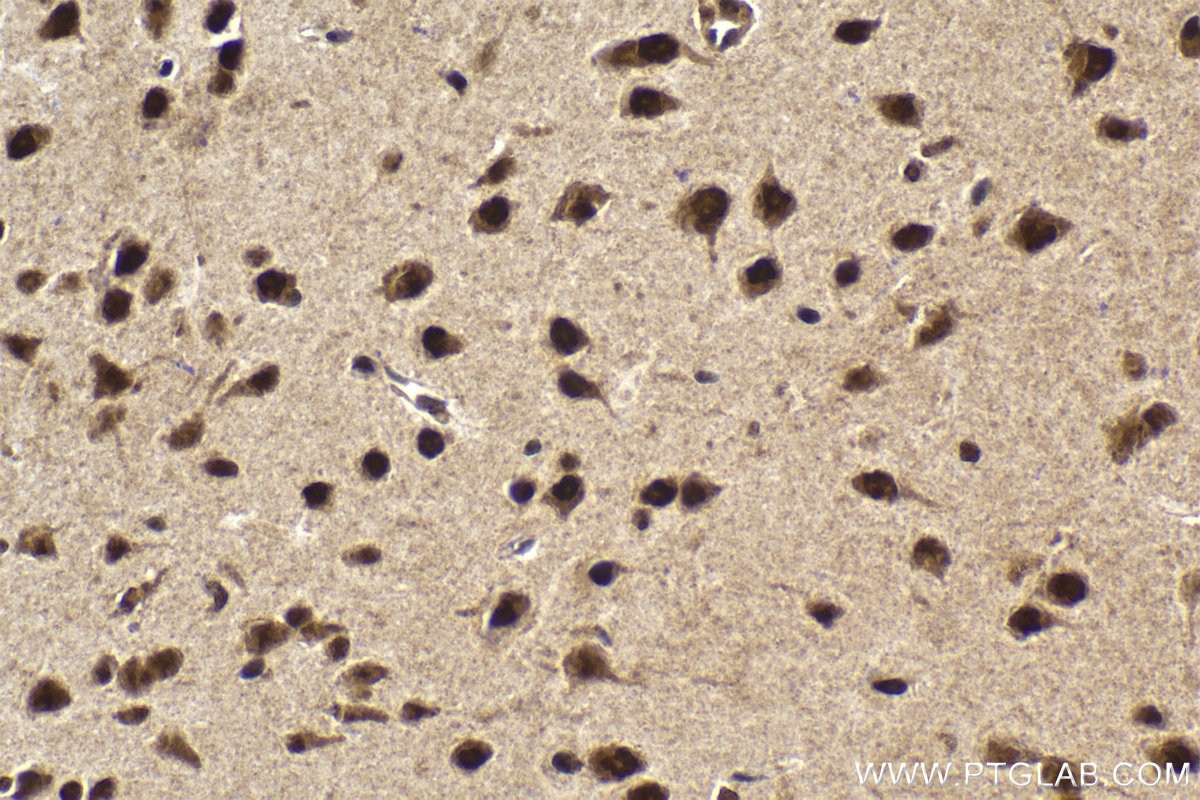 Immunohistochemical analysis of paraffin-embedded mouse brain tissue slide using KHC1998 (ZMYND8 IHC Kit).