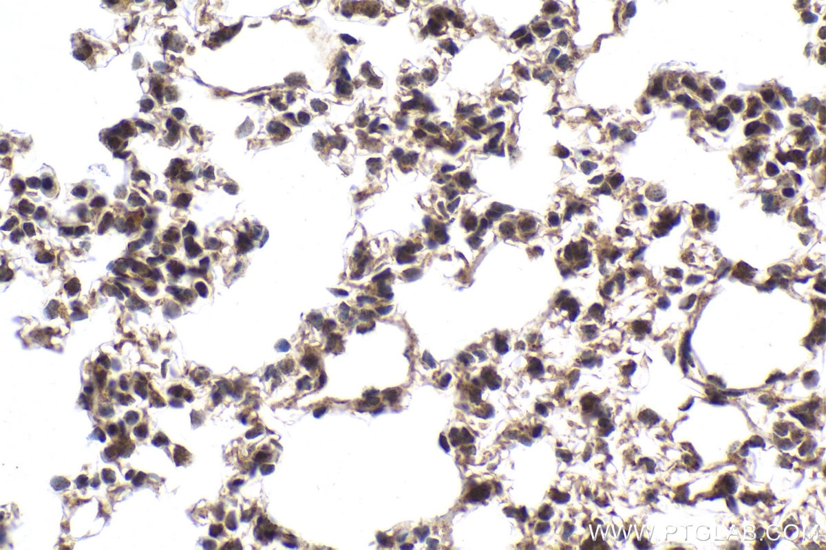 Immunohistochemical analysis of paraffin-embedded mouse lung tissue slide using KHC1998 (ZMYND8 IHC Kit).