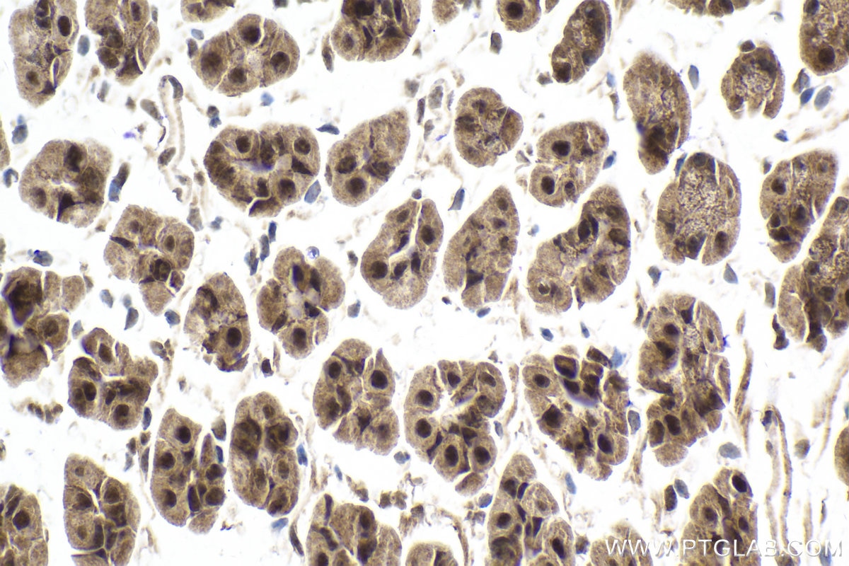 Immunohistochemical analysis of paraffin-embedded mouse stomach tissue slide using KHC1998 (ZMYND8 IHC Kit).