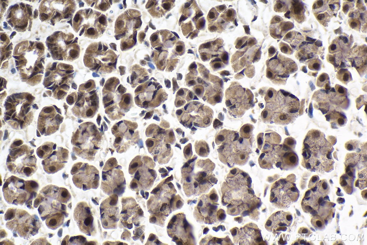 Immunohistochemical analysis of paraffin-embedded rat stomach tissue slide using KHC1998 (ZMYND8 IHC Kit).