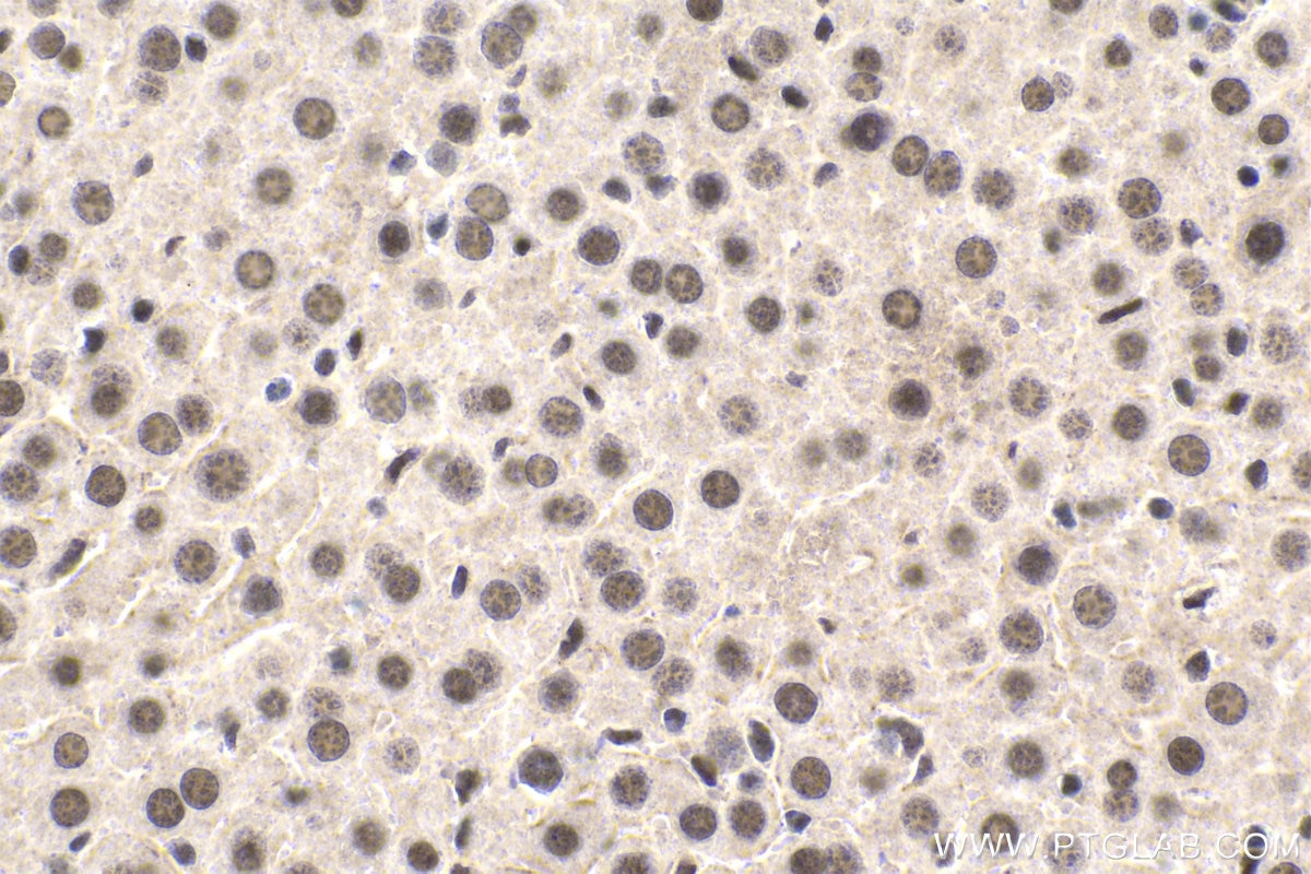 Immunohistochemical analysis of paraffin-embedded mouse liver tissue slide using KHC1826 (ZNF101 IHC Kit).