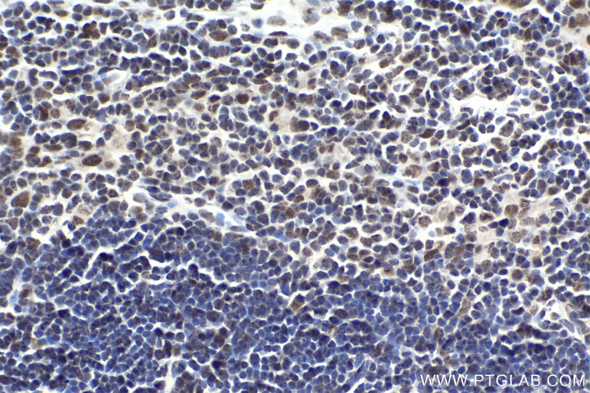 Immunohistochemical analysis of paraffin-embedded mouse thymus tissue slide using KHC1826 (ZNF101 IHC Kit).