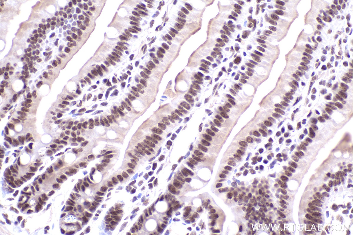 Immunohistochemical analysis of paraffin-embedded mouse small intestine tissue slide using KHC2470 (ZNF638 IHC Kit).