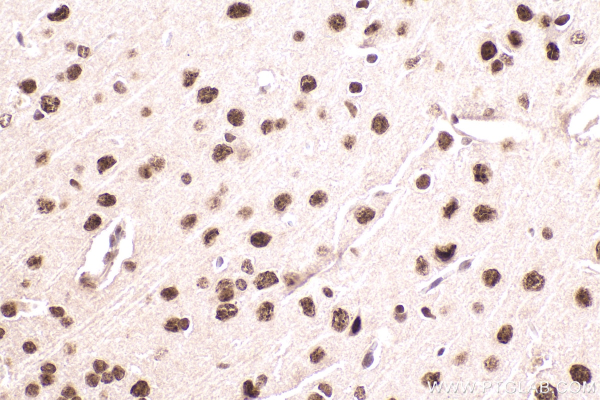 Immunohistochemical analysis of paraffin-embedded mouse brain tissue slide using KHC2470 (ZNF638 IHC Kit).