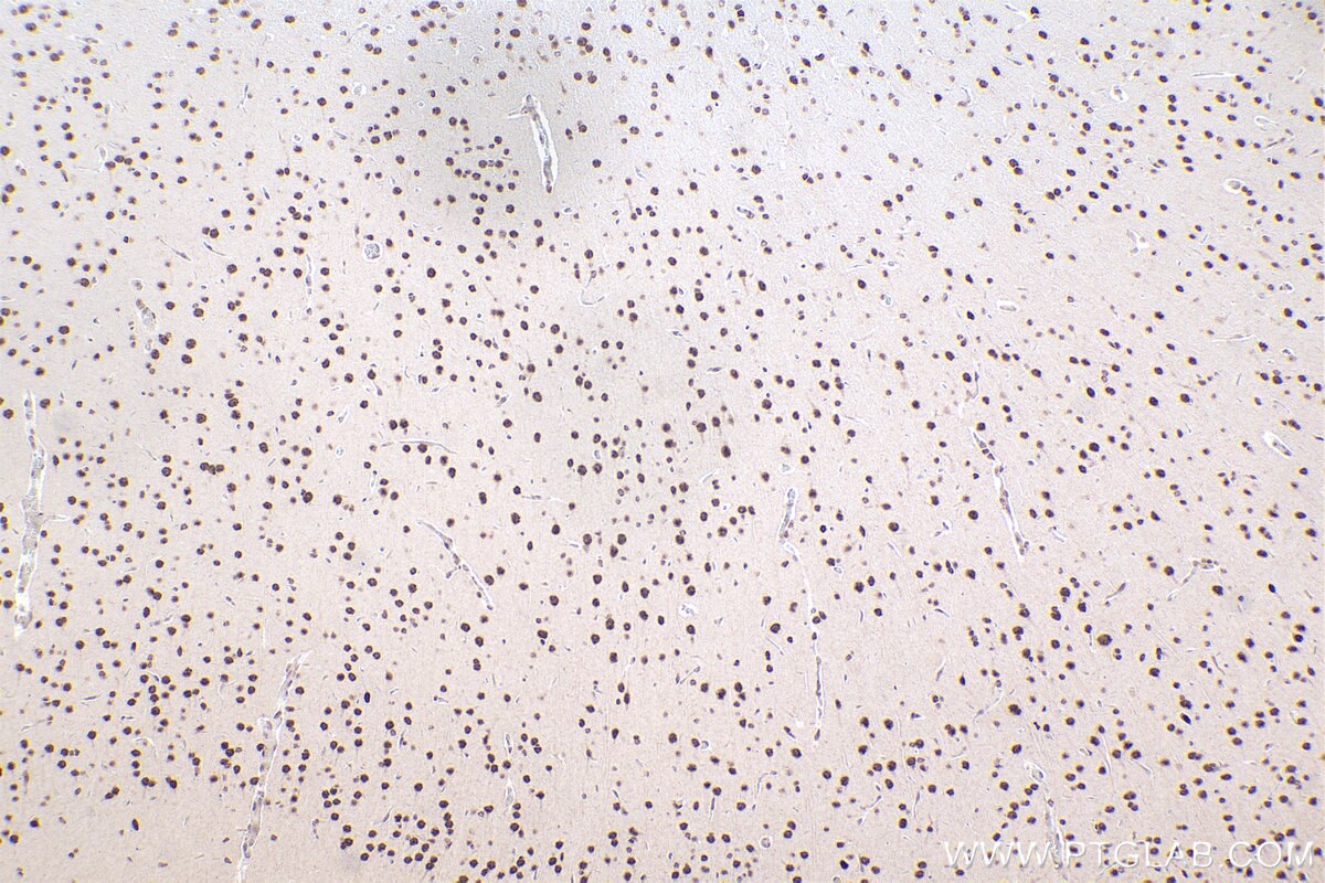 Immunohistochemical analysis of paraffin-embedded rat brain tissue slide using KHC2470 (ZNF638 IHC Kit).