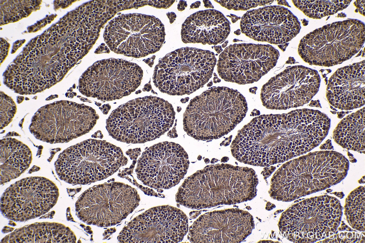 Immunohistochemical analysis of paraffin-embedded mouse testis tissue slide using KHC1787 (ZNF746 IHC Kit).