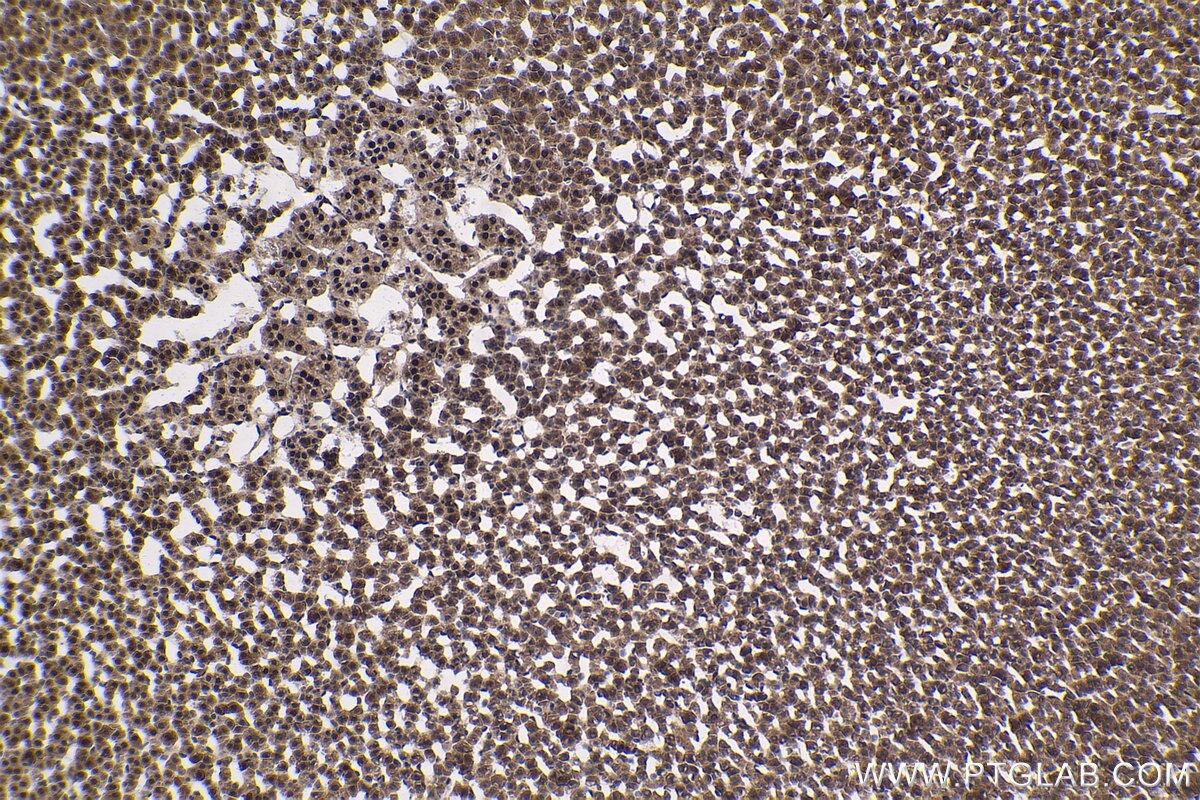 Immunohistochemical analysis of paraffin-embedded rat adrenal gland tissue slide using KHC1787 (ZNF746 IHC Kit).