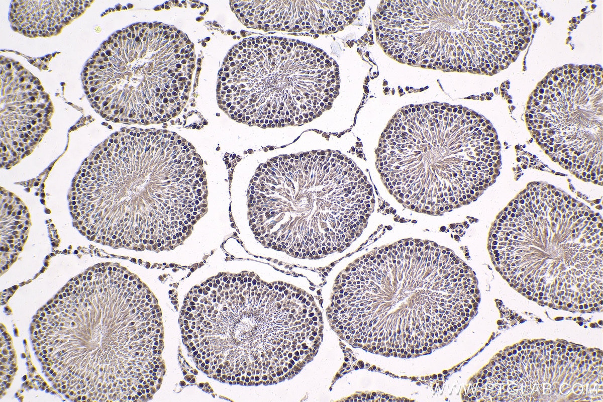 Immunohistochemical analysis of paraffin-embedded rat testis tissue slide using KHC1787 (ZNF746 IHC Kit).