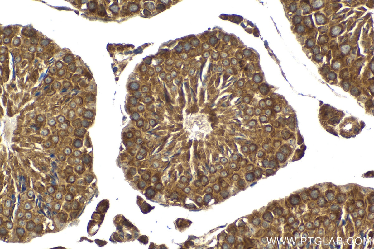 Immunohistochemical analysis of paraffin-embedded mouse testis tissue slide using KHC2078 (ZW10 IHC Kit).