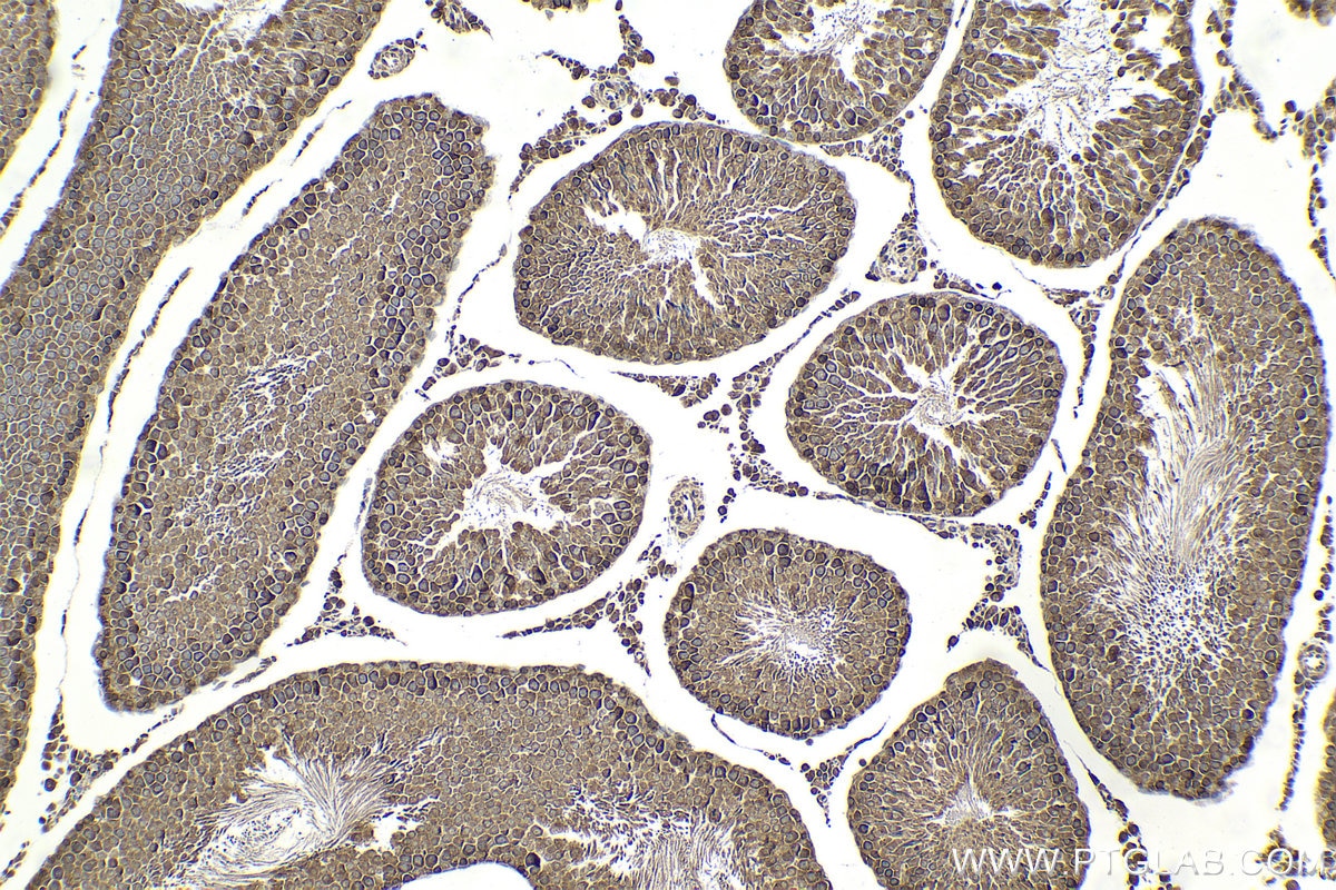 Immunohistochemical analysis of paraffin-embedded rat testis tissue slide using KHC2078 (ZW10 IHC Kit).