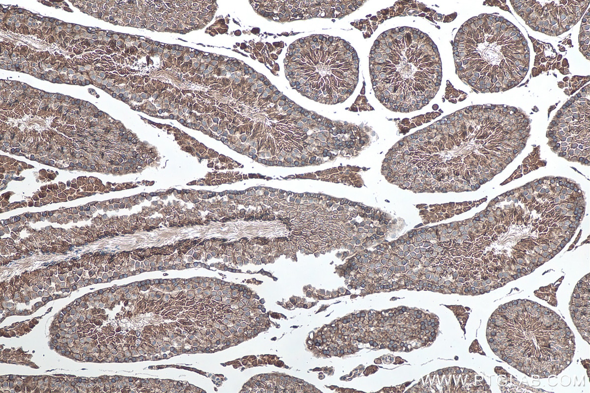 Immunohistochemical analysis of paraffin-embedded mouse testis tissue slide using KHC0117 (c-SRC IHC Kit).