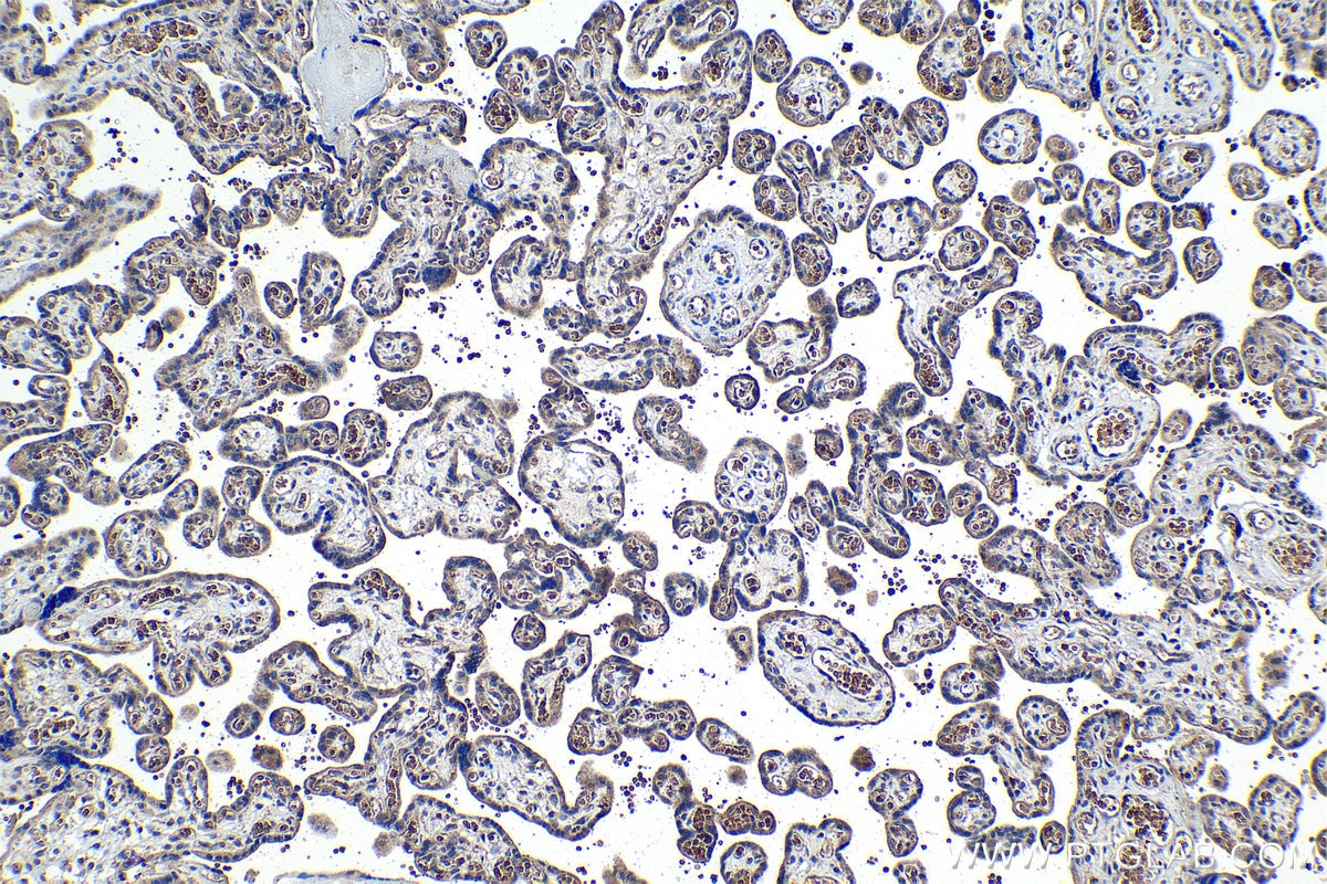 Immunohistochemical analysis of paraffin-embedded human placenta tissue slide using KHC1118 (cIAP2/BIRC3 IHC Kit).