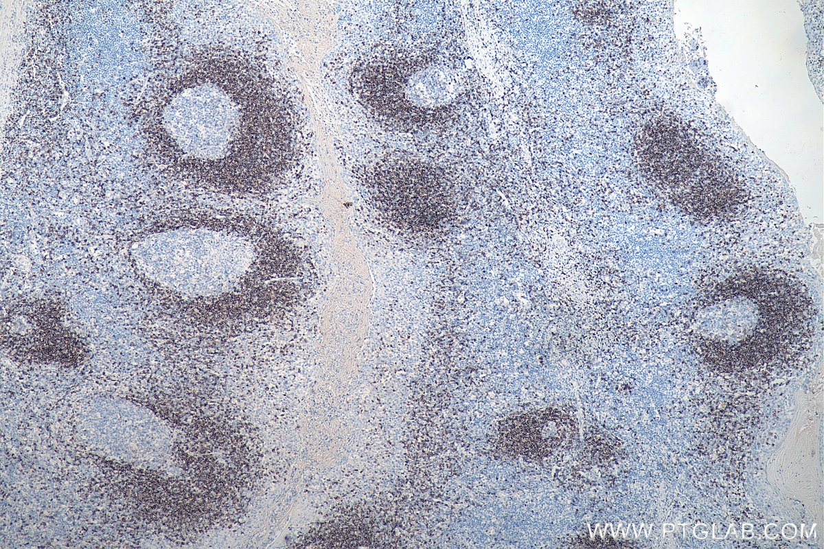 Immunohistochemical analysis of paraffin-embedded human tonsillitis tissue slide using KHC0071 (human IgD IHC Kit).