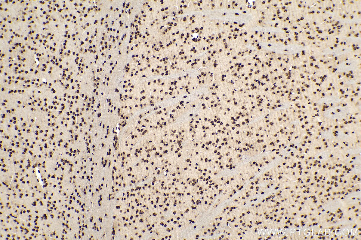 Immunohistochemical analysis of paraffin-embedded mouse brain tissue slide using KHC0807 (m5C IHC Kit).