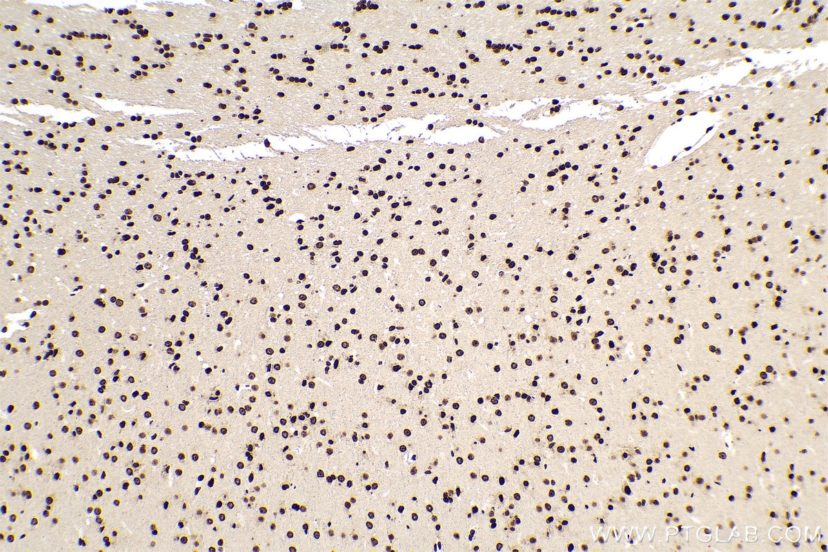 Immunohistochemical analysis of paraffin-embedded rat brain tissue slide using KHC0807 (m5C IHC Kit).