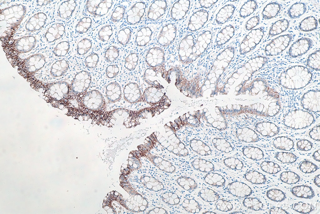 Immunohistochemical analysis of paraffin-embedded human colon tissue slide using KHC0009 (p120 Catenin IHC Kit).