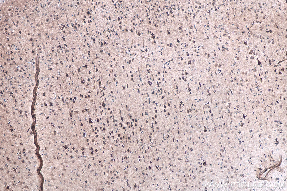 Immunohistochemical analysis of paraffin-embedded rat brain tissue slide using KHC0118 (p38 MAPK IHC Kit).