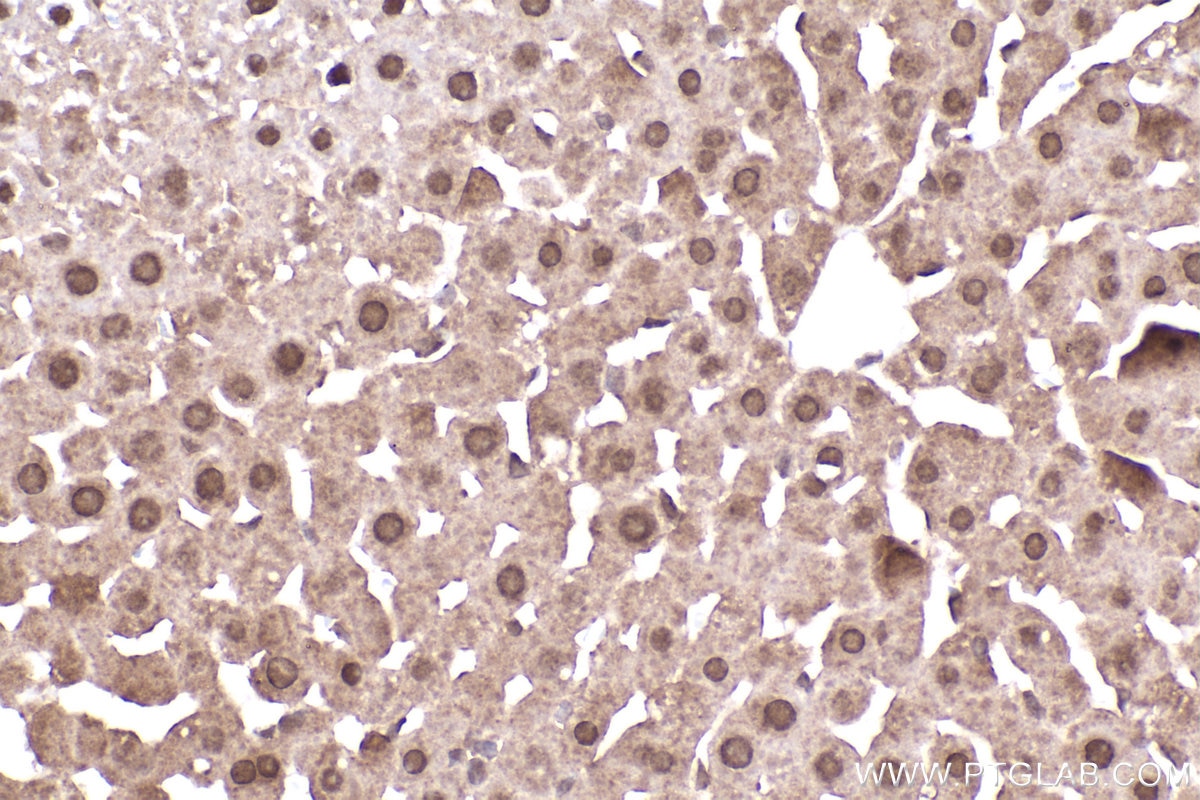 Immunohistochemical analysis of paraffin-embedded rat liver tissue slide using KHC2211 (RPS6KB1 IHC Kit).