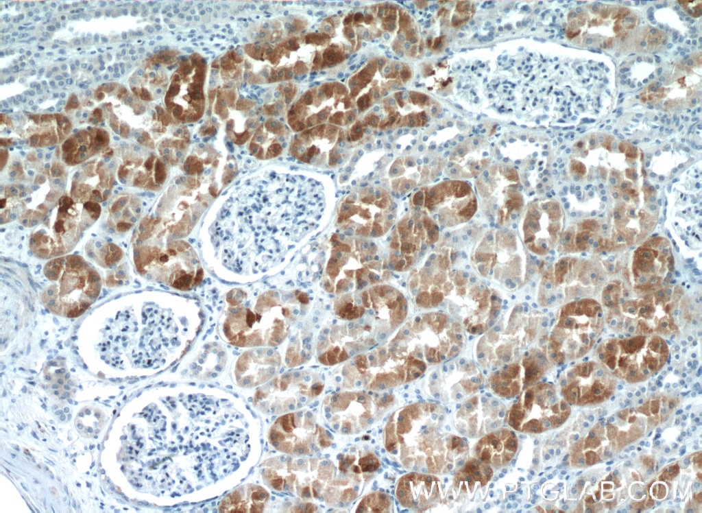 Immunohistochemistry (IHC) staining of human kidney tissue using IHH Polyclonal antibody (13388-1-AP)