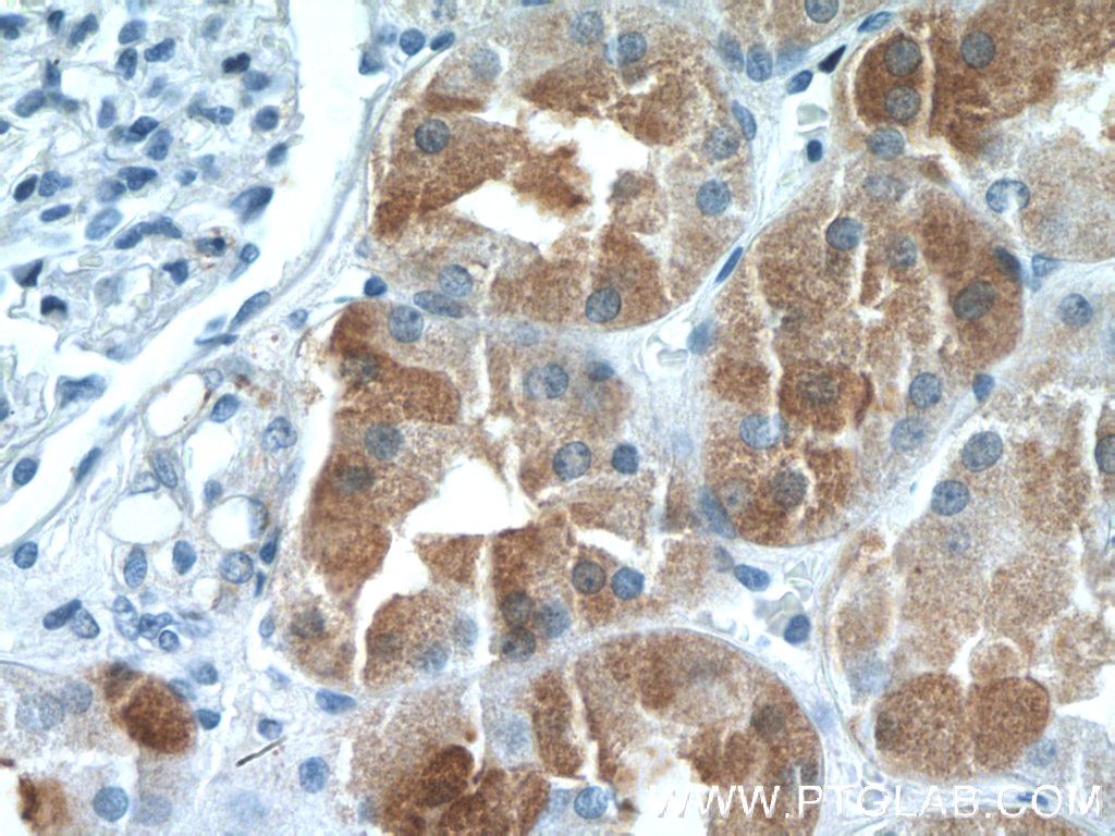 Immunohistochemistry (IHC) staining of human kidney tissue using IHH Polyclonal antibody (13388-1-AP)