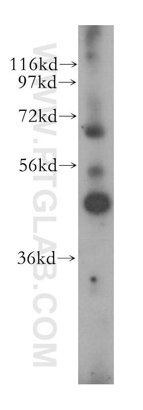 Western Blot (WB) analysis of human heart tissue using IHH Polyclonal antibody (13388-1-AP)