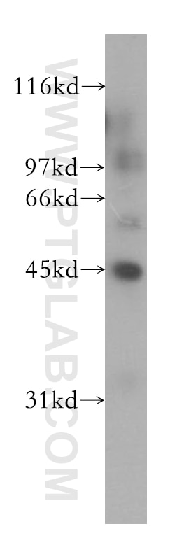 Western Blot (WB) analysis of human kidney tissue using IHH Polyclonal antibody (13388-1-AP)