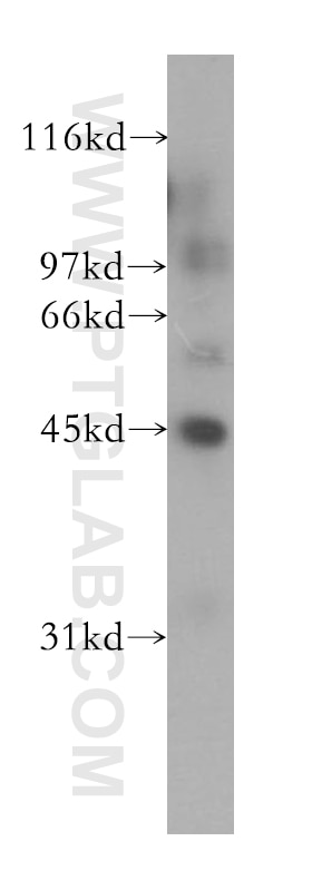 WB analysis of human kidney using 13388-1-AP