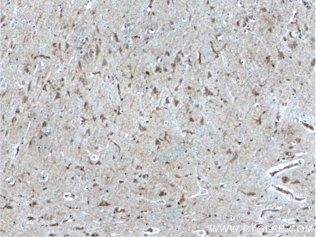 IHC staining of human brain using 20630-1-AP