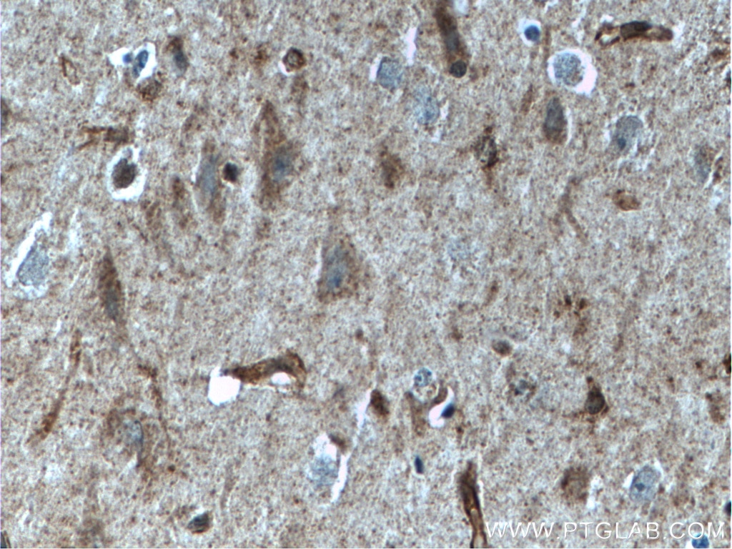 Immunohistochemistry (IHC) staining of human brain tissue using IIP45 Polyclonal antibody (20630-1-AP)