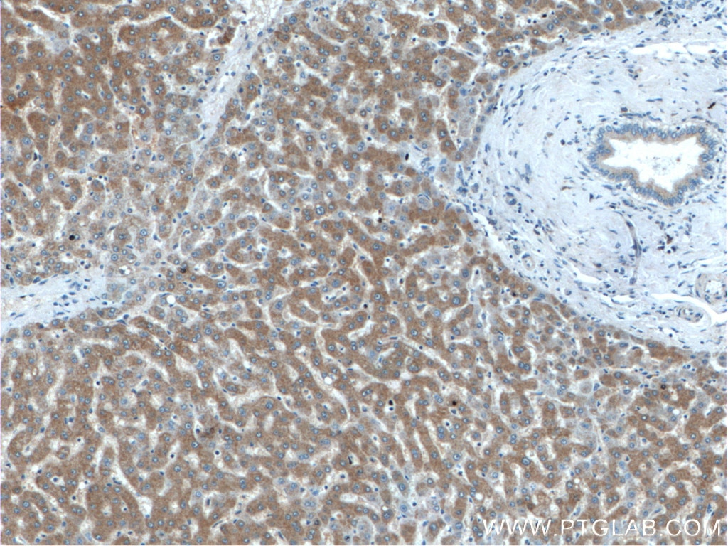 Immunohistochemistry (IHC) staining of human liver tissue using IIP45 Polyclonal antibody (20630-1-AP)