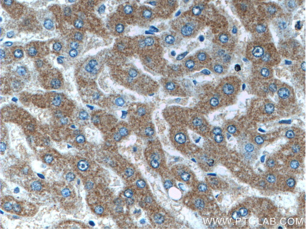 Immunohistochemistry (IHC) staining of human liver tissue using IIP45 Polyclonal antibody (20630-1-AP)