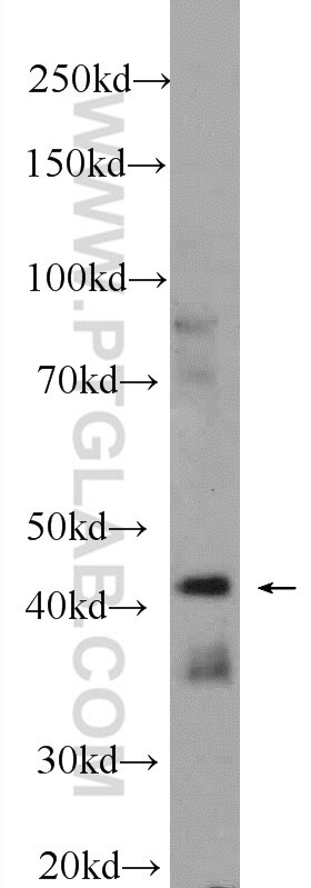 Western Blot (WB) analysis of fetal human brain tissue using IIP45 Polyclonal antibody (20630-1-AP)