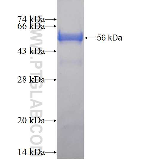 IIP45 fusion protein Ag14609 SDS-PAGE