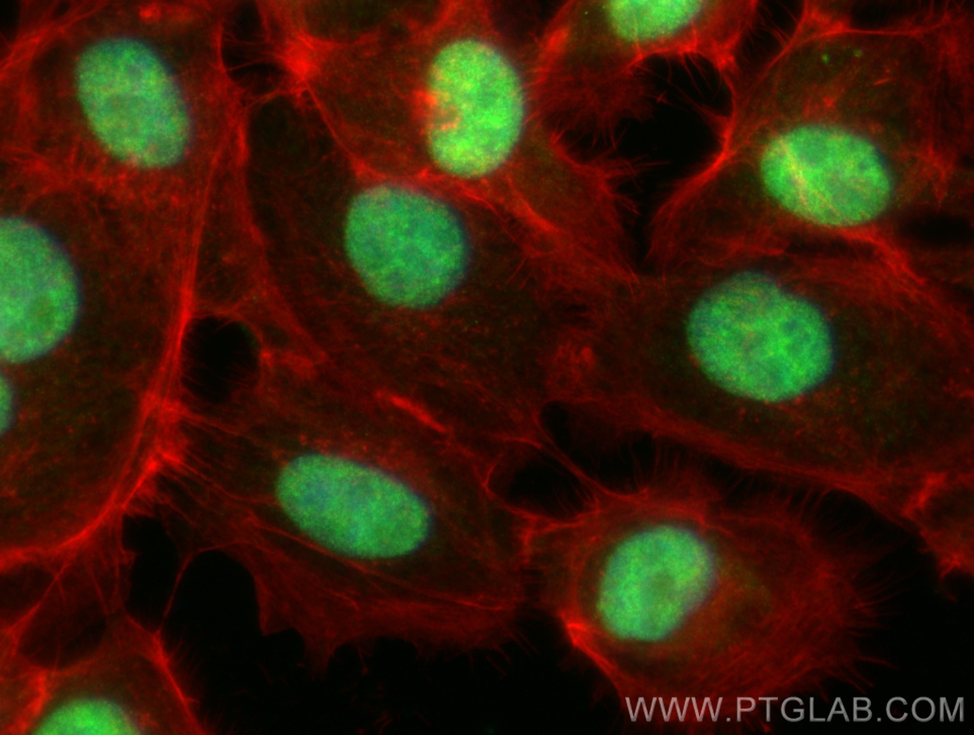 Immunofluorescence (IF) / fluorescent staining of A431 cells using IK Polyclonal antibody (31833-1-AP)