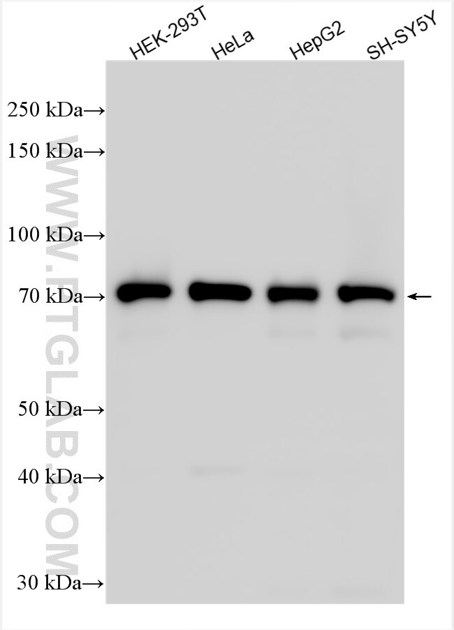 Western Blot (WB) analysis of various lysates using IK Polyclonal antibody (31833-1-AP)