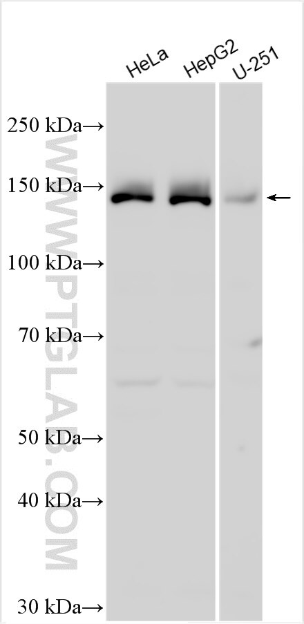 Western Blot (WB) analysis of various lysates using IKBKAP Polyclonal antibody (31705-1-AP)