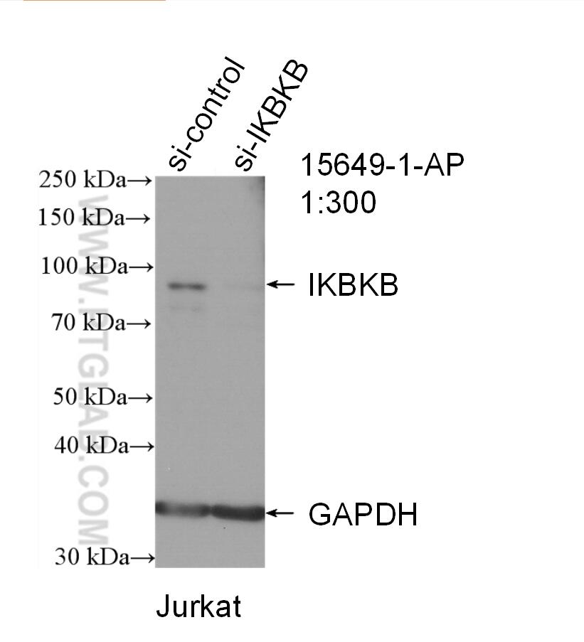 Western Blot (WB) analysis of Jurkat cells using IKBKB Polyclonal antibody (15649-1-AP)