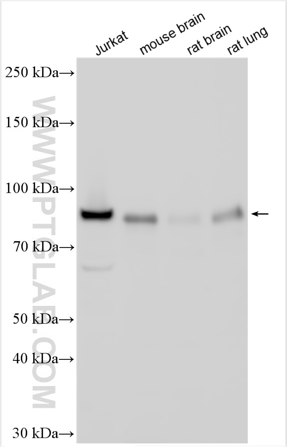 Western Blot (WB) analysis of various lysates using IKKB Polyclonal antibody (15649-1-AP)