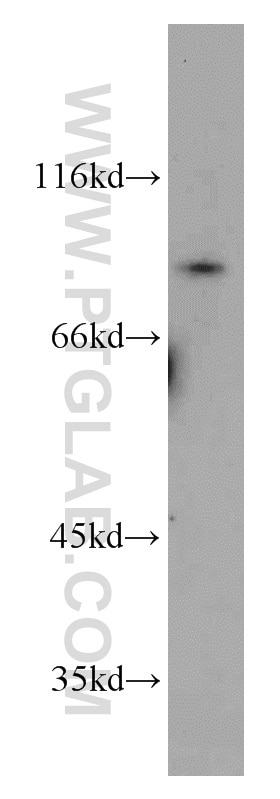 Western Blot (WB) analysis of HepG2 cells using IKBKB Polyclonal antibody (15649-1-AP)
