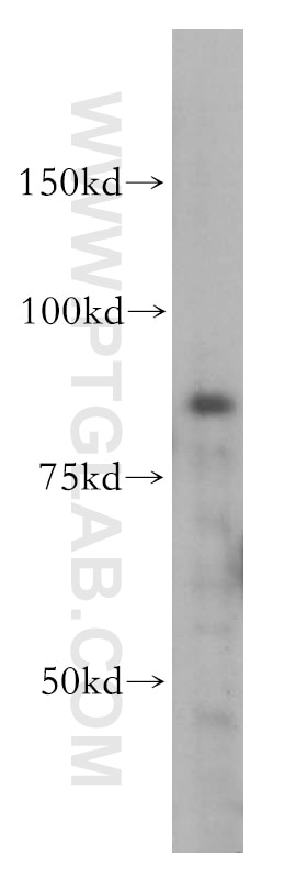 Western Blot (WB) analysis of K-562 cells using IKBKB Polyclonal antibody (15649-1-AP)