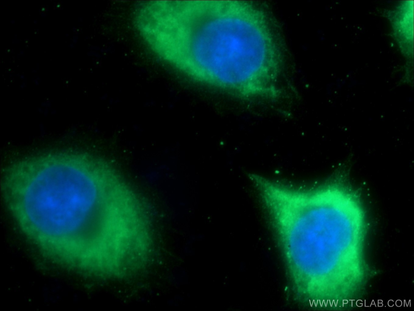 Immunofluorescence (IF) / fluorescent staining of DU 145 cells using IKBKB Polyclonal antibody (20979-1-AP)
