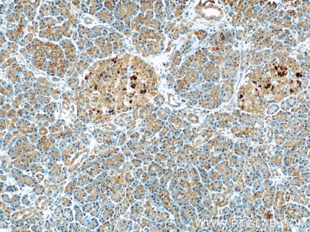 Immunohistochemistry (IHC) staining of human pancreas tissue using IKBKB Polyclonal antibody (20979-1-AP)