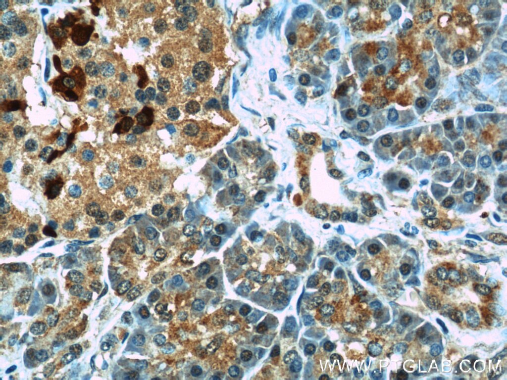 Immunohistochemistry (IHC) staining of human pancreas tissue using IKBKB Polyclonal antibody (20979-1-AP)