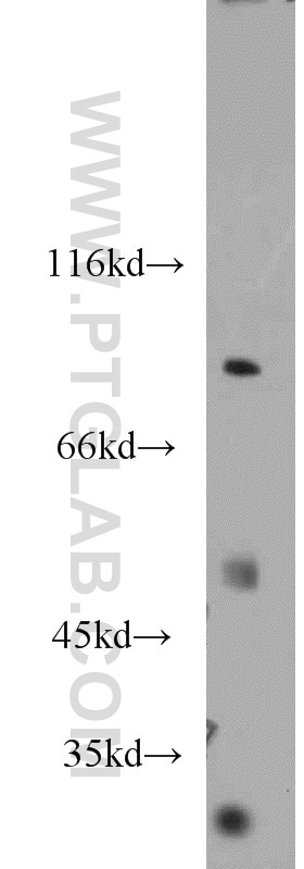 Western Blot (WB) analysis of mouse testis tissue using IKBKB Polyclonal antibody (20979-1-AP)