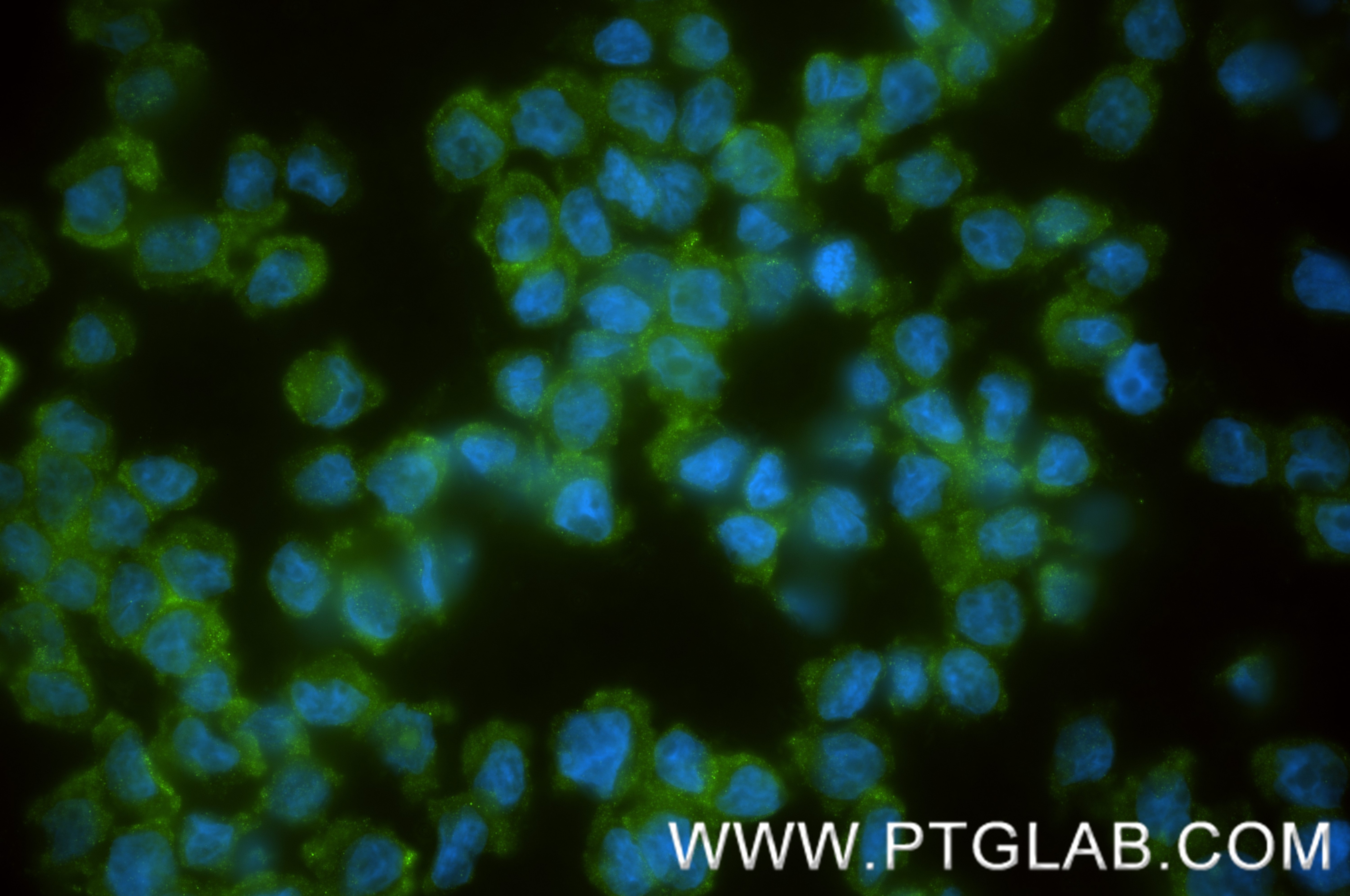 Immunofluorescence (IF) / fluorescent staining of THP-1 cells using IKKB Recombinant antibody (81347-2-RR)
