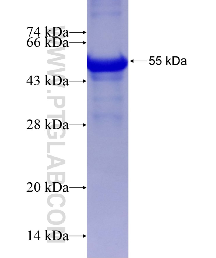 IKBKB fusion protein Ag8191 SDS-PAGE
