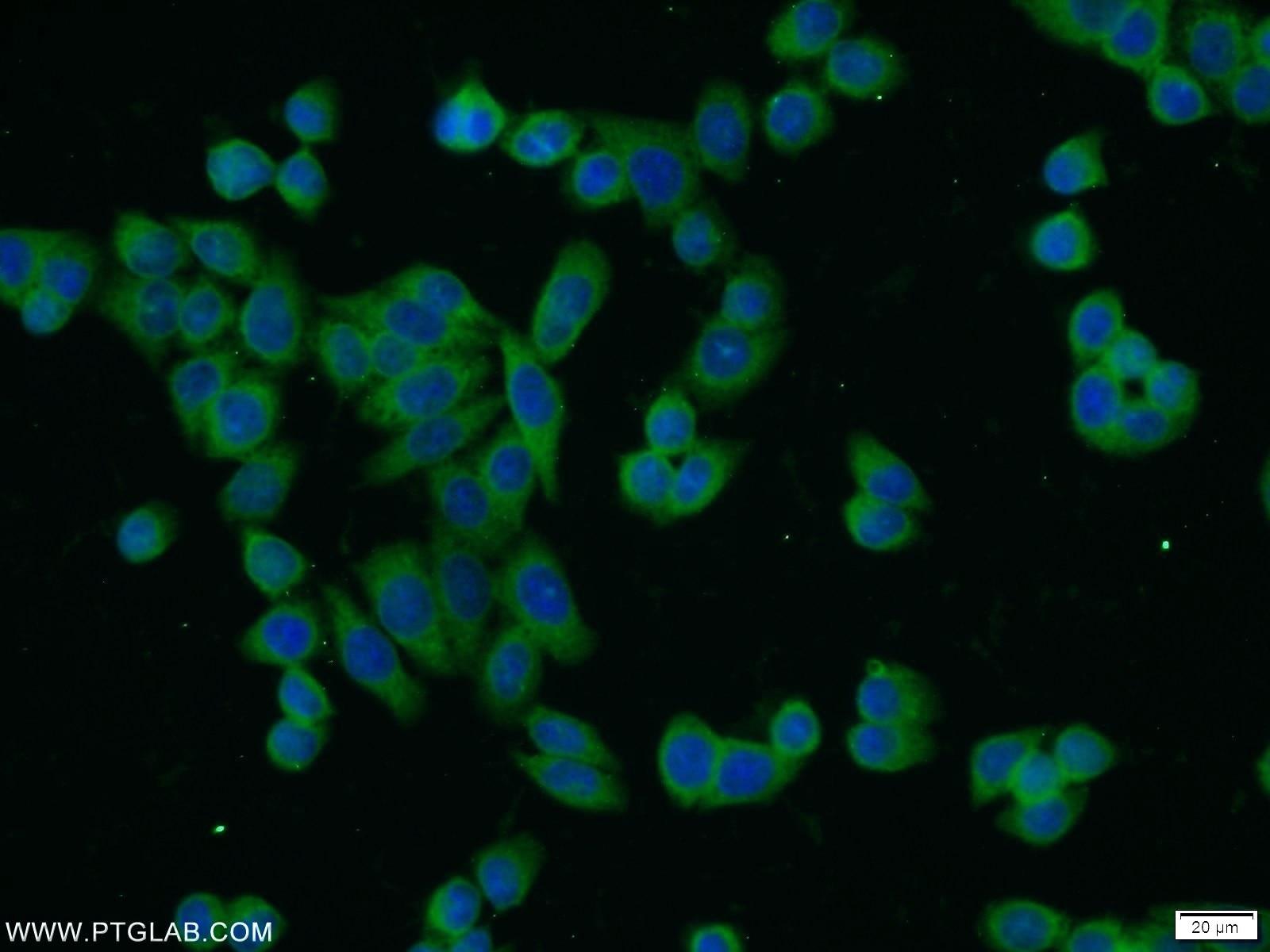Immunofluorescence (IF) / fluorescent staining of HeLa cells using IKBKG Polyclonal antibody (18474-1-AP)