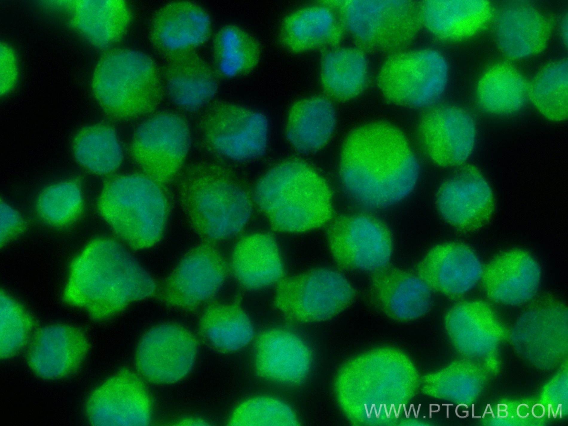 Immunofluorescence (IF) / fluorescent staining of K-562 cells using IKBKG Polyclonal antibody (18474-1-AP)