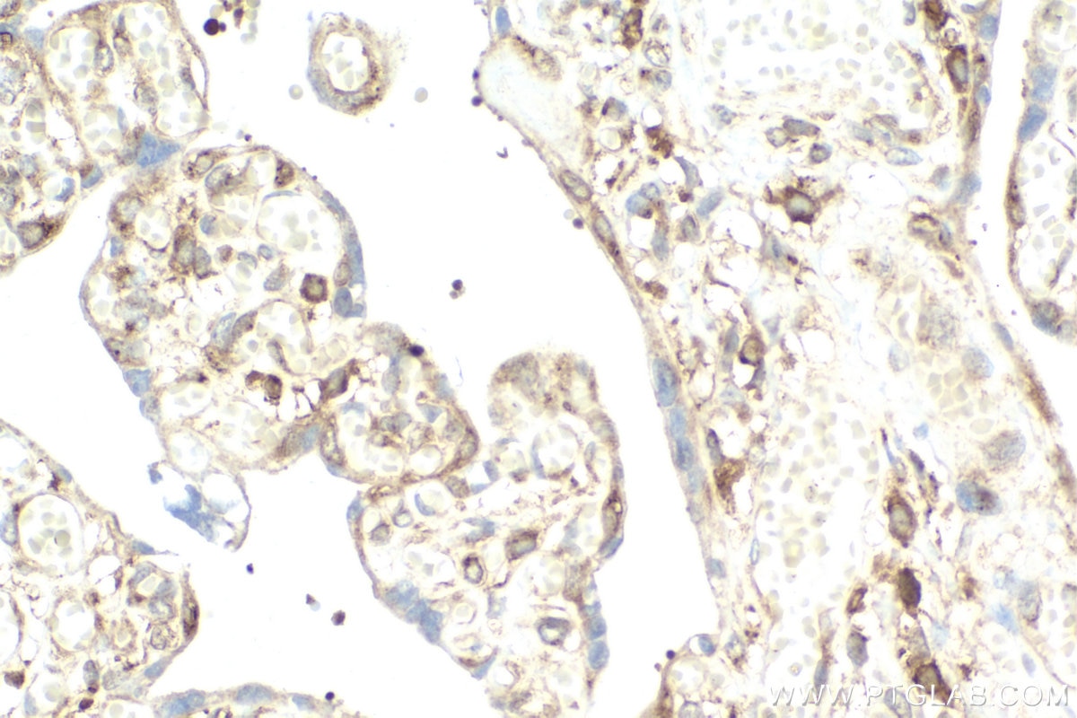 Immunohistochemistry (IHC) staining of human placenta tissue using IKBKG Polyclonal antibody (18474-1-AP)