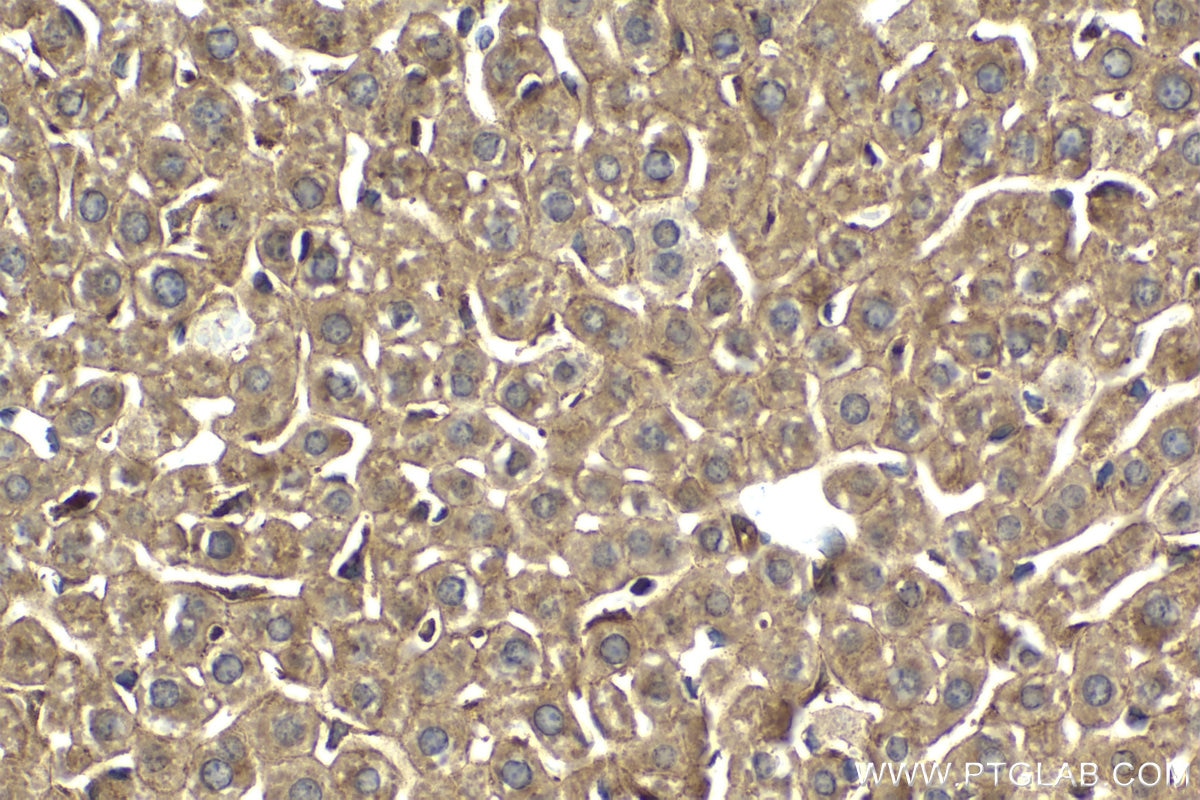 Immunohistochemistry (IHC) staining of mouse liver tissue using IKBKG Polyclonal antibody (18474-1-AP)